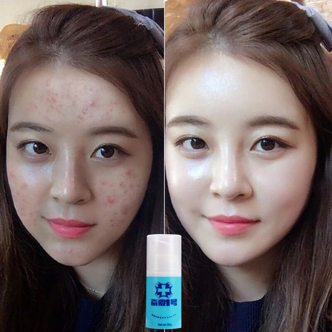 祛斑这样调理效果好 祛斑这样调理效果好