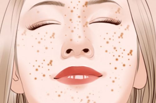 斑的形成原因中医看法