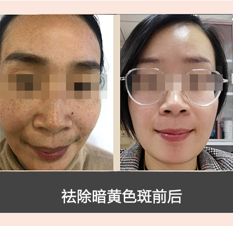 素颜肌肤_养_护_修