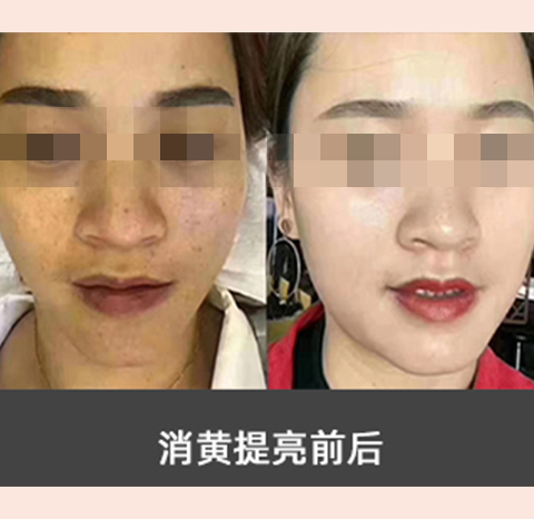 素颜肌肤_养_护_修