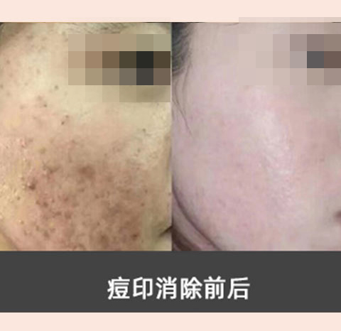 素颜肌肤_养_护_修