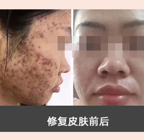 素颜肌肤_养_护_修