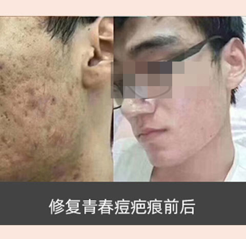 素颜肌肤_养_护_修