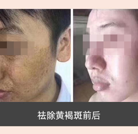 素颜肌肤_养_护_修