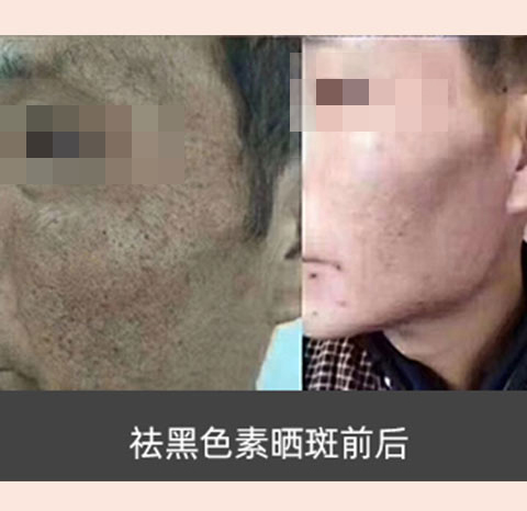 素颜肌肤_养_护_修