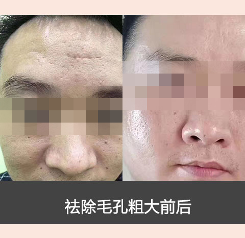 素颜肌肤_养_护_修