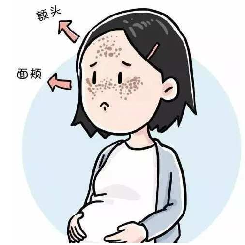 为什么会长斑? 为什么会长斑?